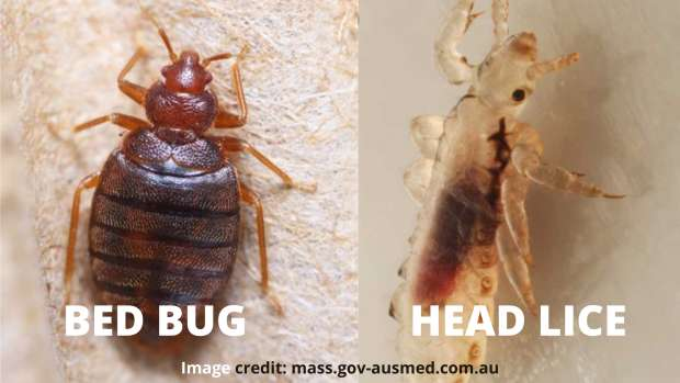 Bed Bugs vs Head Lices