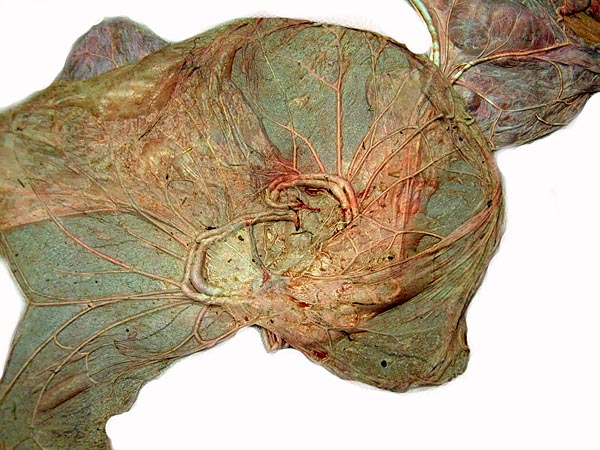 Fetal surface of rhinoceros placentas with short umbilical cord