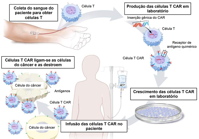  Esquema do processo de obtenção d e células CAR-T - droga-viva no combate ao câncer