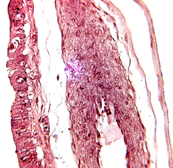 Allanto-chorionic membrane. Chorion at left and the thin amnion is at right. The center shows a large allantoic blood vessel