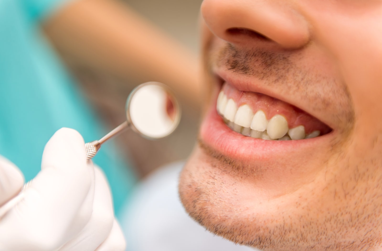 An image of a man's teeth while a dentist looks at them with a mouth mirror