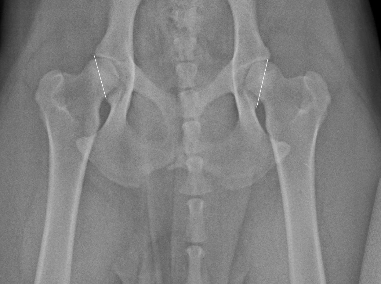X-ray of a hip bone

Description automatically generated