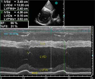 ECHO examination of a horse. Short-axis 2-D ECHO (top) and corresponding M-mode ECHO (below) of the LV at the chordal level obtained from the right cardiac window at an imaging depth of 30 cm. IVS, interventricular septum; arrow, pericardium. LV mass = 1.04 x ((13.20 + 2.40 + 3.49)3 - 13.203) - 13.6 = 4830 g. 