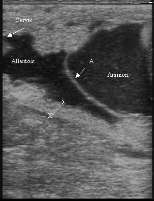 Ecografía transrectal en una yegua al final de la gestación. A = membrana amniótica; x---x = espesor conjunto útero-placentario (ECUP). El ECUP se mide entre la rama media de la arteria uterina y el alantoides.