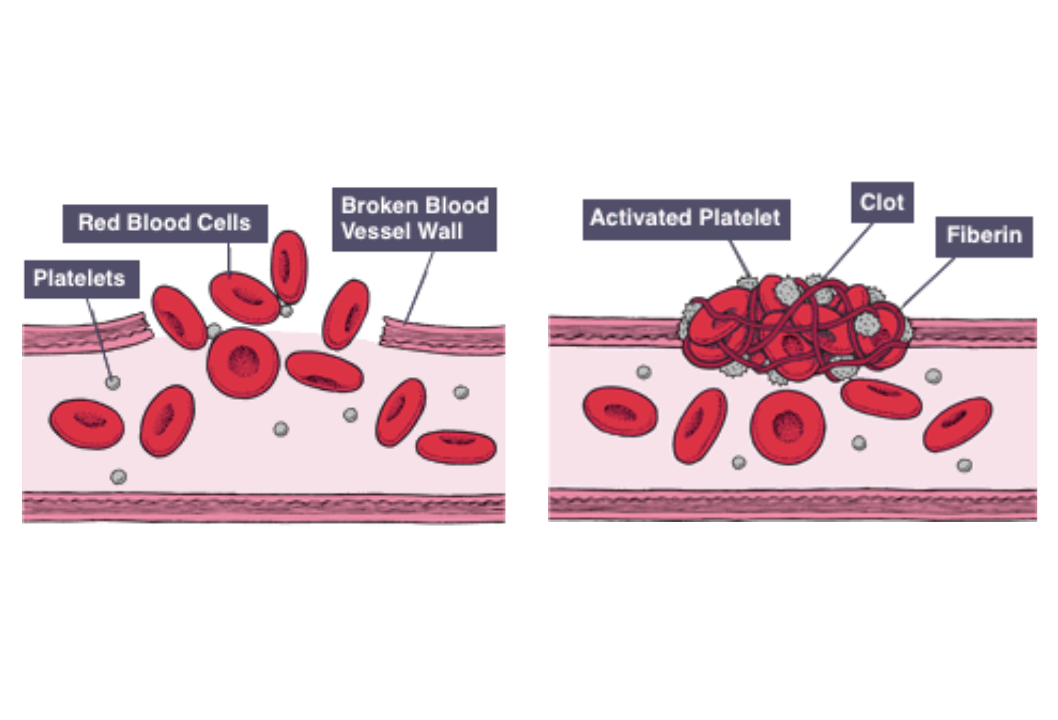 IGCSE Biology Notes 2 62 Understand That Platelets Are Involved In 