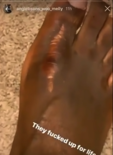 A close up of a person's foot

Description automatically generated with low confidence