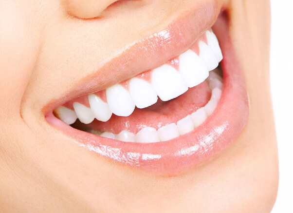 bọc răng sứ thẩm mỹ mang lại nụ cười hoàn hảo