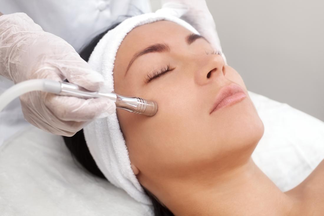 Microdermabrasion: Benefits, uses, procedure, and risks