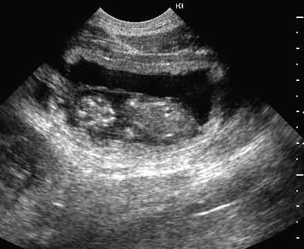 Sonogram of a pregnant bitch 37 days after the LH surge, showing the fetus in dorsal section from the head (left) to caudal abdomen (right)