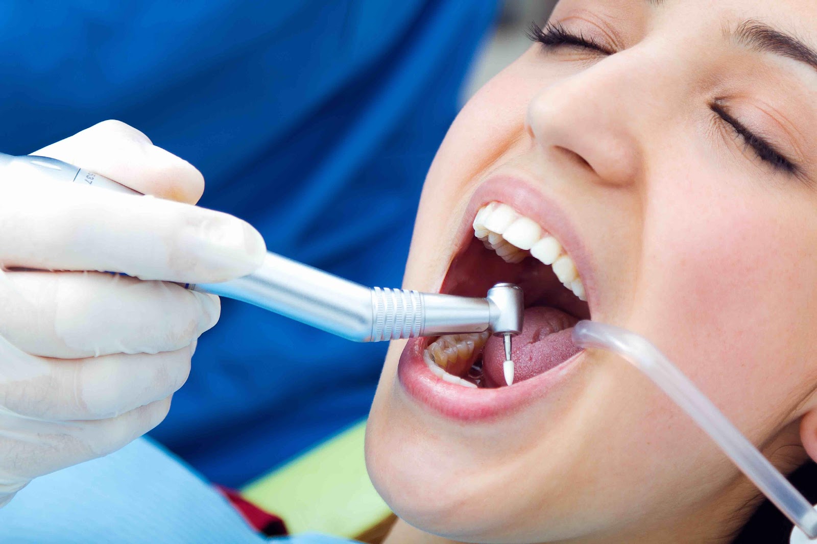 how to hire the professionals dentist