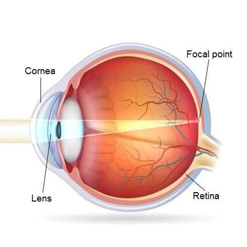 Eye structure - Diopta