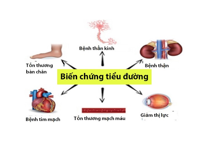 Biến chứng nguy hiểm của bệnh Tiểu đường.